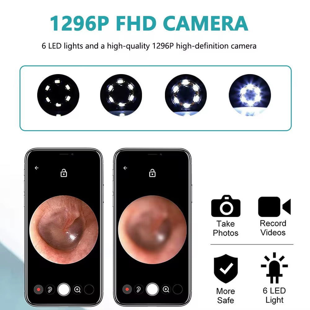 🔥 Nettoyeur d’oreilles intelligent avec caméra HD – Prenez soin de vos oreilles avec précision et sécurité ! 🔥